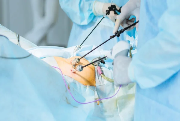 Laparoscopic Surgery