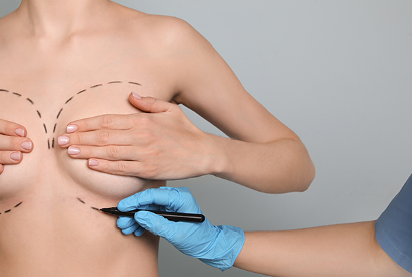 Breast Surgery