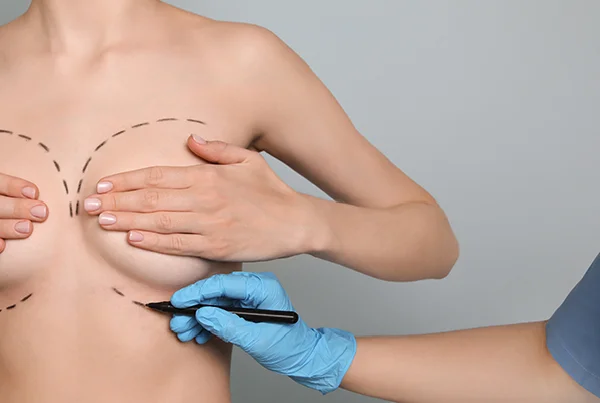 Breast Surgery